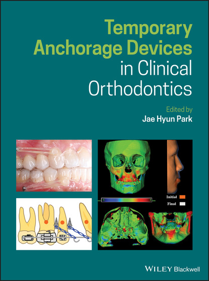 Temporary Anchorage Devices in Clinical Orthodontics - Группа авторов