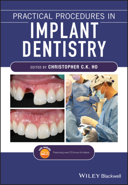 Practical Procedures in Implant Dentistry - Группа авторов