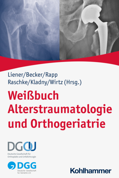 Wei?buch Alterstraumatologie und Orthogeriatrie - Группа авторов