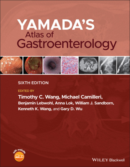 Yamada's Atlas of Gastroenterology — Группа авторов