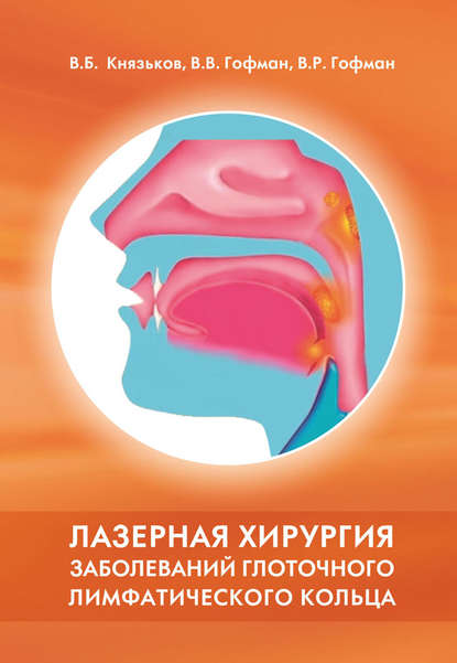 Лазерная хирургия заболеваний глоточного лимфатического кольца — Владимир Князьков