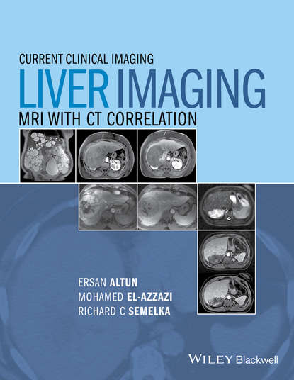 Liver Imaging - Группа авторов
