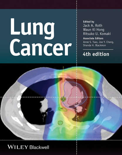 Lung Cancer - Группа авторов