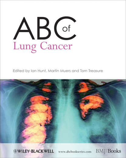 ABC of Lung Cancer - Группа авторов