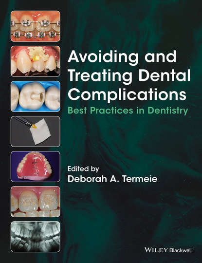 Avoiding and Treating Dental Complications - Группа авторов