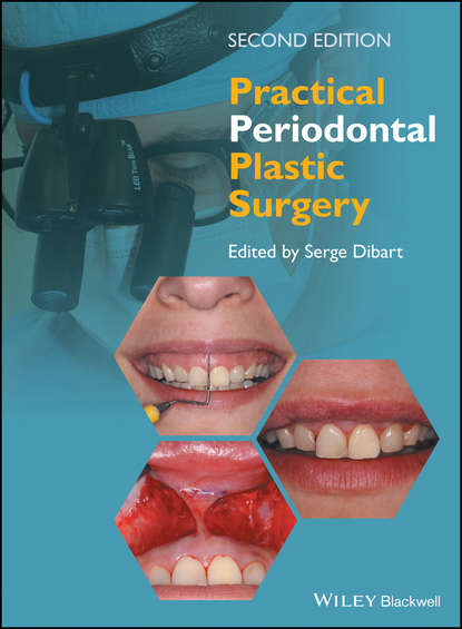 Practical Periodontal Plastic Surgery - Группа авторов