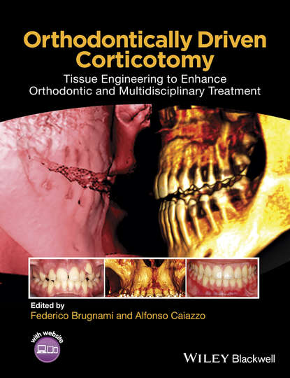 Orthodontically Driven Corticotomy - Группа авторов