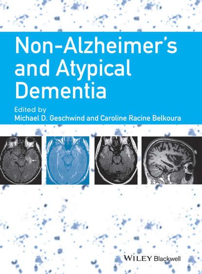 Non-Alzheimer's and Atypical Dementia - Группа авторов