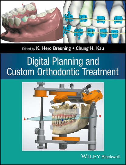 Digital Planning and Custom Orthodontic Treatment - Группа авторов