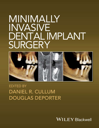 Minimally Invasive Dental Implant Surgery - Группа авторов