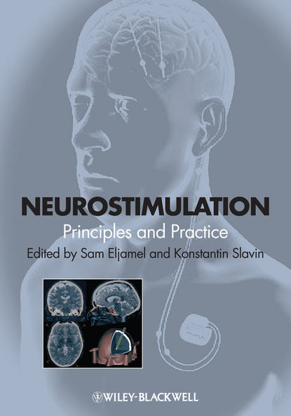 Neurostimulation - Группа авторов