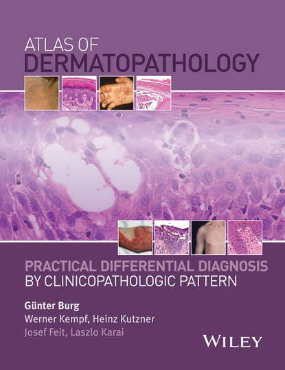 Atlas of Dermatopathology - Группа авторов